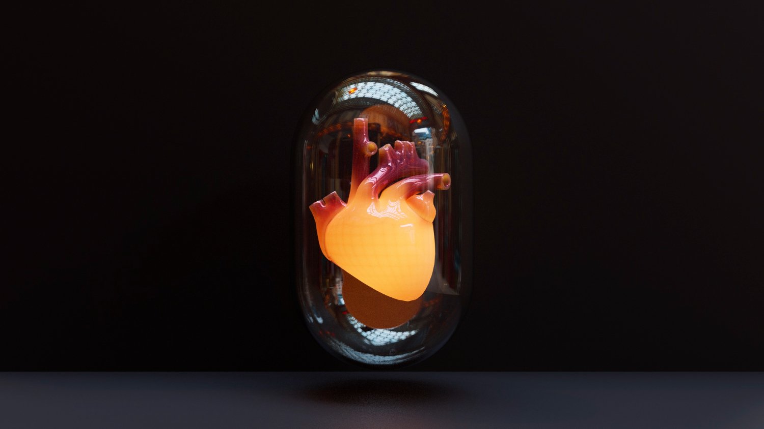 Anévrysme de l'aorte