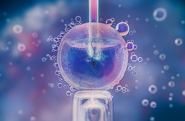 Fertilisation in vitro sans séjour