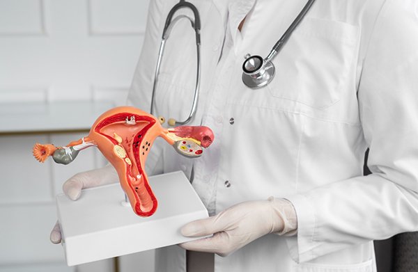 Hystérectomie laparoscopique