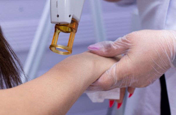 Traitement des cicatrices par Laser